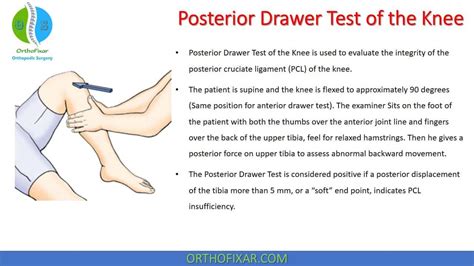 ccl tear drawer test|knee drawer test results.